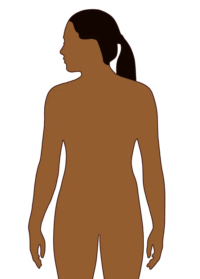 Body outlines used to show where vitiligo patches appear