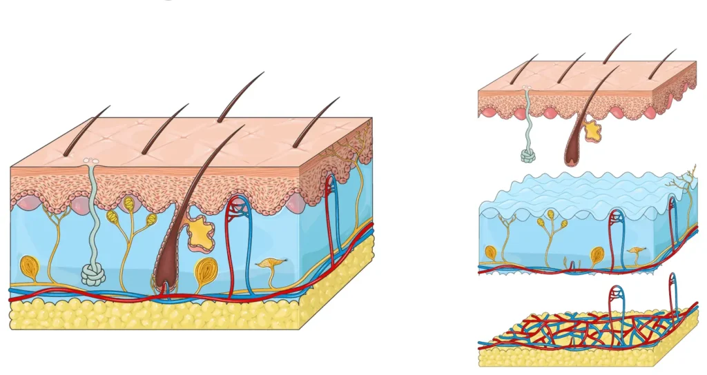 Skin layers reached by eczema creams compared with tablets and injections